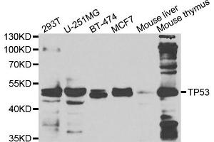 Western blot analysis of extracts of various cell lines, using TP53 antibody. (p53 Antikörper)