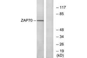 Western blot analysis of extracts from Jurkat cells, using ZAP-70 (Ab-319) Antibody. (ZAP70 Antikörper  (AA 286-335))