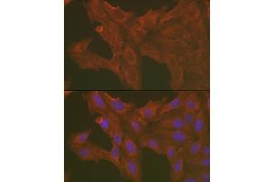 Immunofluorescence analysis of U2OS cells using [KO Validated] Caspase-3 Rabbit pAb (ABIN6131582, ABIN6137962, ABIN6137964 and ABIN6215049) at dilution of 1:100 (40x lens). (Caspase 3 Antikörper  (AA 55-160))