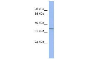 C17ORF78 antibody used at 1 ug/ml to detect target protein. (C17orf78 Antikörper  (Middle Region))