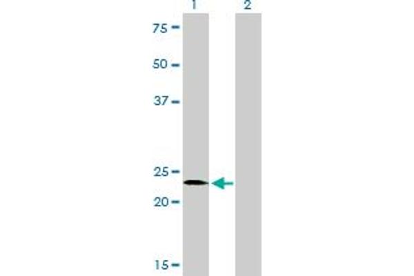 SALL2 Antikörper  (AA 1-198)