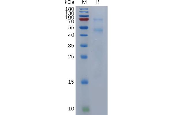 BMP6 Protein (AA 21-513) (His tag)