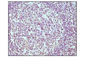 Immunohistochemistry (IHC) image for anti-CD19 Molecule (CD19) antibody (ABIN1105970) (CD19 Antikörper)