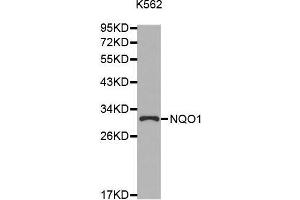 Western blot analysis of extracts of K562 cell line, using NQO1 antibody. (NQO1 Antikörper  (AA 1-274))