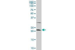 LATS1 monoclonal antibody (M09), clone 3A7. (LATS1 Antikörper  (AA 521-620))