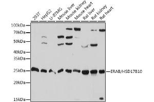 Western blot analysis of extracts of various cell lines, using ERAB/HSD17B10 Rabbit mAb (ABIN1513420, ABIN3021162, ABIN3021163 and ABIN7101350) at 1:1000 dilution. (HSD17B10 Antikörper)
