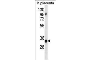 Western blot analysis in human placenta tissue lysates (35ug/lane). (OR6N2 Antikörper  (C-Term))