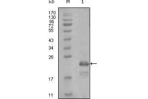 Western Blot showing HAND1 antibody used against truncated Trx-HAND1 recombinant protein (1). (HAND1 Antikörper  (AA 90-190))