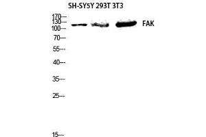 Western Blot (WB) analysis of SH-SYSY 293 3T3 lysis using FAK antibody. (FAK Antikörper  (Thr444))