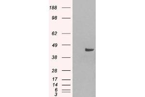 Western Blotting (WB) image for anti-Sorting Nexin 16 (SNX16) antibody (ABIN5877322) (SNX16 Antikörper)