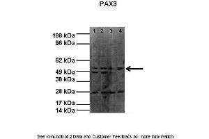 Lanes:   Lane1: 20ug RH30 lysate Lane2: 20ug RH30 lysate Lane3: 20ug RH41 lysate Lane4: 20ug RH41 lysate  Primary Antibody Dilution:   1:1000  Secondary Antibody:    Donkey anti-rabbit HRP  Secondary Antibody Dilution:   1:4000  Gene Name:   PAX3  Submitted by:   Dr Joanna Selfe, Institute of Cancer Research (Paired Box 3 Antikörper  (N-Term))