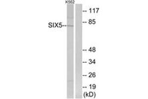 Western Blotting (WB) image for anti-Homeobox protein SIX5 (SIX5) (AA 201-250) antibody (ABIN2890384) (Six5 Antikörper  (AA 201-250))