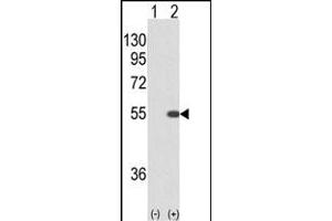 Western blot analysis of STK40 (arrow) using rabbit polyclonal STK40 (C-term) (ABIN652973 and ABIN2842617). (STK40 Antikörper  (C-Term))