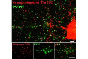 Image no. 2 for anti-Synaptotagmin I (SYT1) (pThr202) antibody (ABIN372724) (SYT1 Antikörper  (pThr202))