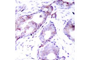 Immunohistochemistry (IHC) image for anti-Myc Proto-Oncogene protein (MYC) (pSer373) antibody (ABIN1870452) (c-MYC Antikörper  (pSer373))
