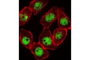 Immunofluorescence (IF) image for anti-Cyclin-Dependent Kinase Inhibitor 1C (p57, Kip2) (CDKN1C) antibody (ABIN2995933) (CDKN1C Antikörper)