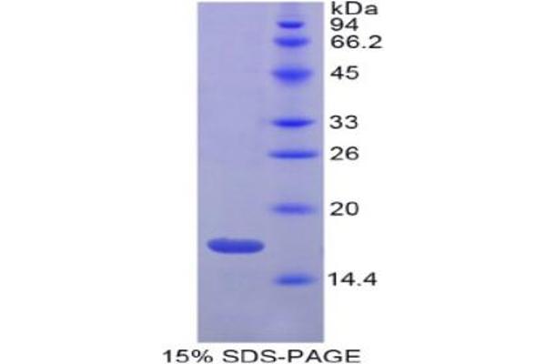 Gastrokine 3 Protein (GKN3)