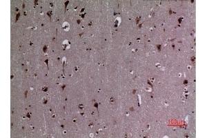 Immunohistochemical analysis of paraffin-embedded human-brain, antibody was diluted at 1:100. (HSP90 Antikörper  (acLys284, acLys292))