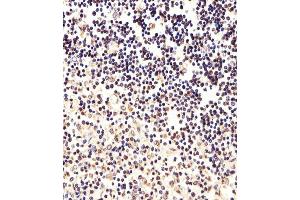 Immunohistochemical analysis of paraffin-embedded H. (FOXP1 Antikörper  (C-Term))