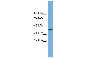 WB Suggested Anti-SPRY4 Antibody Titration:  0. (SPRY4 Antikörper  (Middle Region))
