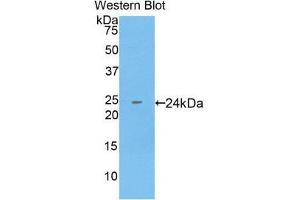 Western Blotting (WB) image for anti-Keratin 18 (KRT18) (AA 238-396) antibody (ABIN1859576) (Cytokeratin 18 Antikörper  (AA 238-396))