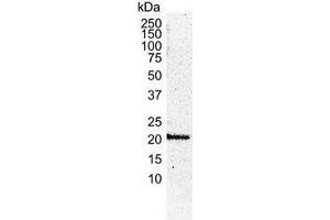 Western Blotting (WB) image for anti-HRas proto-oncogene, GTPase (HRAS) antibody (ABIN2473919) (HRAS Antikörper)