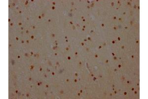 Immunohistochemistry (IHC) image for anti-Poly (ADP-Ribose) Polymerase 1 (PARP1) antibody (ABIN7127667)