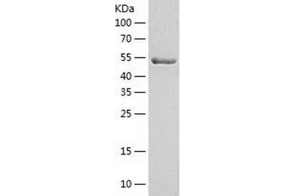 PDIA3 Protein (AA 25-505) (His tag)