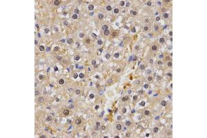 Immunohistochemistry of paraffin-embedded rat liver using HSF2 antibody. (HSF2 Antikörper)