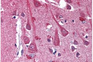 Human Brain, Cortex (formalin-fixed, paraffin-embedded) stained with CXCR4 antibody ABIN301627 at 10 ug/ml followed by biotinylated anti-mouse IgG secondary antibody ABIN481714, alkaline phosphatase-streptavidin and chromogen. (CXCR4 Antikörper)