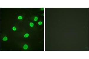 Immunofluorescence analysis of HeLa cells, using Histone H4 (Acetyl-Lys5) Antibody. (Histone H4 Antikörper  (acLys5))