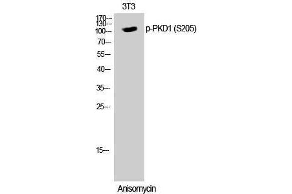 PKD1 Antikörper  (pSer205)