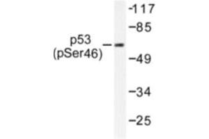 Image no. 1 for anti-Tumor Protein P53 (TP53) (pSer46) antibody (ABIN318094) (p53 Antikörper  (pSer46))