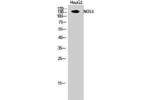 Western Blotting (WB) image for anti-Nitric Oxide Synthase 3 (Endothelial Cell) (NOS3) (Thr180) antibody (ABIN3180214) (ENOS Antikörper  (Thr180))