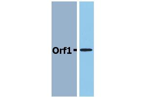 Western Blotting analysis (reducing conditions) of recombinant protein Orf1 in cell lysate of Orf1-transfected E. (Neisseria Meningitidis Antigen Orf1 Antikörper)