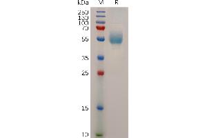 Human GCGR Protein, hFc Tag on SDS-PAGE under reducing condition. (Glucagon Receptor Protein (GCGR) (AA 26-136) (Fc Tag))