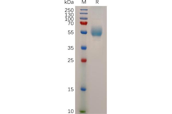 Glucagon Receptor Protein (GCGR) (AA 26-136) (Fc Tag)