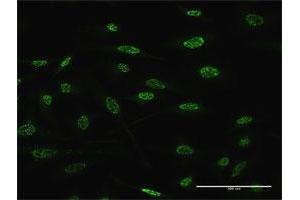 Immunofluorescence of monoclonal antibody to TGIF2 on HeLa cell. (TGIF2 Antikörper  (AA 114-175))