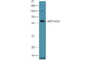 HepG2 lysate probed with Rabbit Anti-AKT1+2+3 Polyclonal Antibody (ABIN1387781) at 1:300 overnight in 4 °C. (AKT 1/2/3 Antikörper  (AA 401-480))