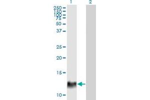 Western Blot analysis of HBXIP expression in transfected 293T cell line by HBXIP monoclonal antibody (M12), clone 4G1. (HBXIP Antikörper  (AA 83-173))