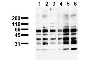 Western Blotting (WB) image for anti-Phosphoserine (phosphorylated) antibody (ABIN126862) (Phosphoserine Antikörper  (phosphorylated))