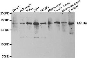 Western blot analysis of extracts of various cell lines, using SMC1A antibody. (SMC1A Antikörper)