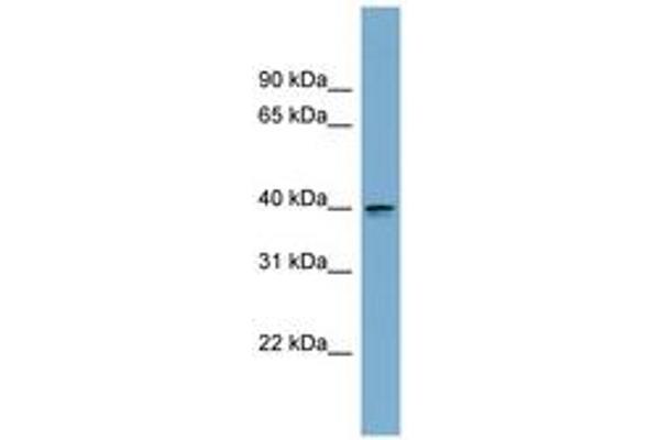ASPHD2 Antikörper  (AA 107-156)