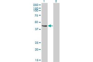 Western Blotting (WB) image for anti-Tumor Susceptibility Gene 101 (TSG101) (AA 201-280) antibody (ABIN563269)