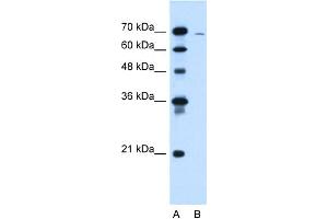 WB Suggested Anti-CLCC1 Antibody Titration:  1. (CLCC1 Antikörper  (N-Term))