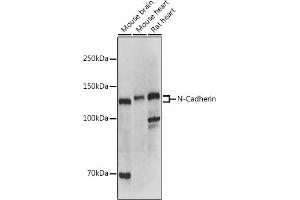 Western blot analysis of extracts of various cell lines, using N-Cadherin antibody (ABIN1684127, ABIN1514384, ABIN5663657 and ABIN6213846) at 1:500 dilution. (N-Cadherin Antikörper  (AA 450-550))