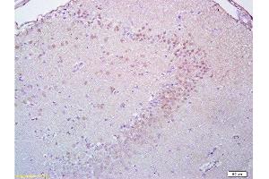 Formalin-fixed and paraffin embedded rat brain tissue labeled with Anti-Brdu Polyclonal Antibody, Unconjugated  at 1:200, followed by conjugation to the secondary antibody and DAB staining (BrdU Antikörper)