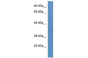 Western Blot showing Tmem110 antibody used at a concentration of 1. (TMEM110 Antikörper  (C-Term))