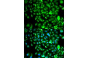 Immunofluorescence analysis of  cells using CSRP2BP antibody (ABIN6127664, ABIN6139138, ABIN6139139 and ABIN6223242). (CSRP2BP Antikörper  (AA 523-782))