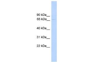 PARP6 antibody used at 1. (PARP6 Antikörper  (N-Term))